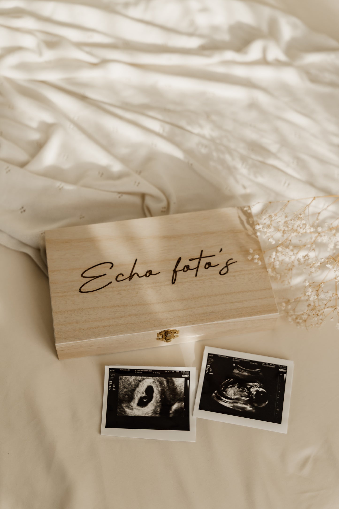 Bewaardoos voor echo foto's